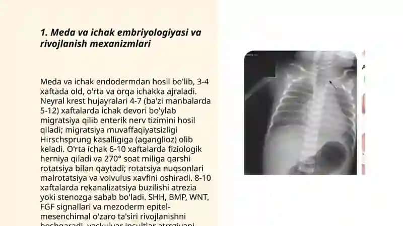 Meda va ichak embriyologiyasi va rivojlanish mexanizmlari 3