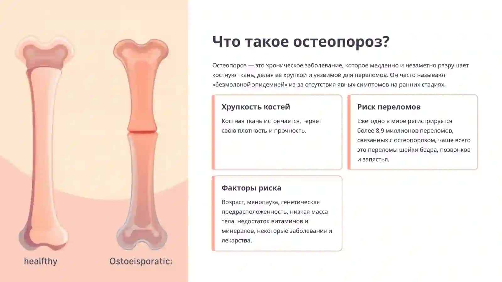 Витамины и средства для лечения остеопороза: современный взгляд 3