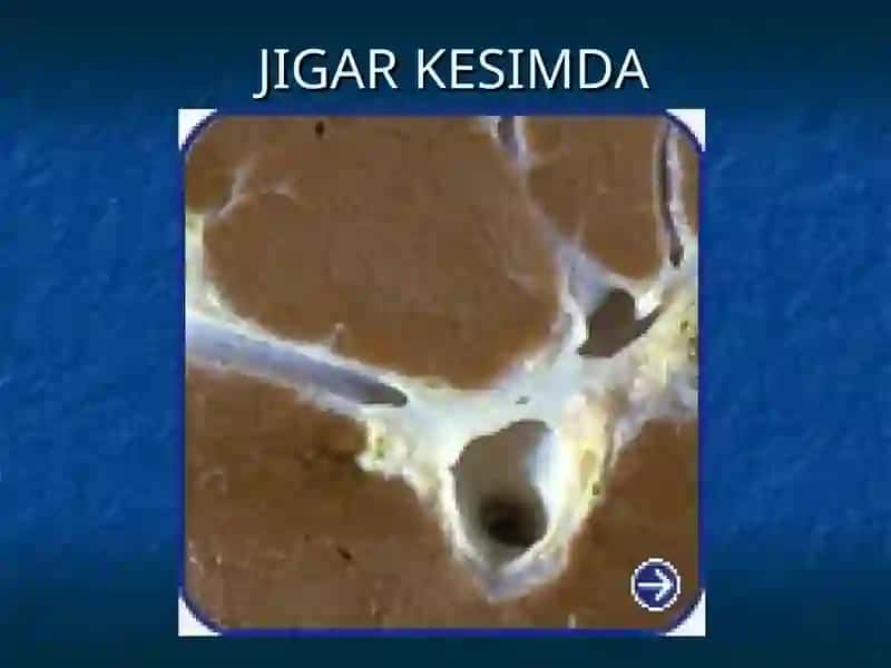 JIGARSIRROZI 3