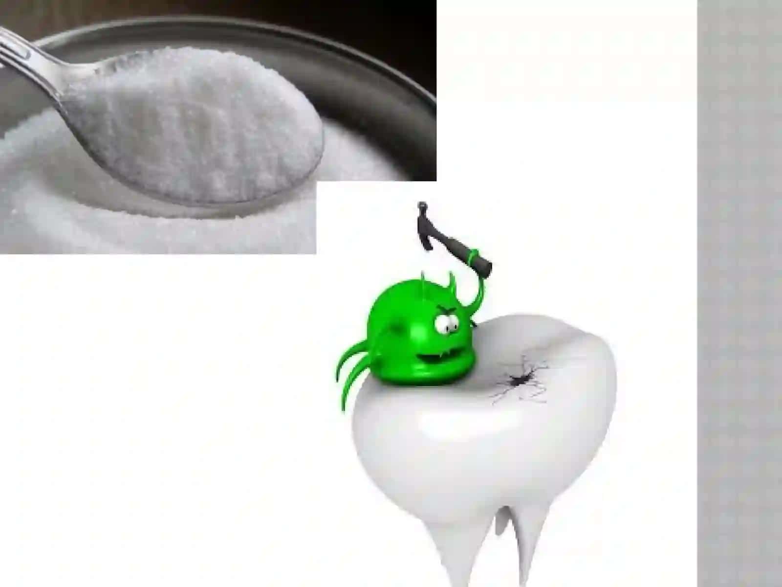 Кариес зуба 3