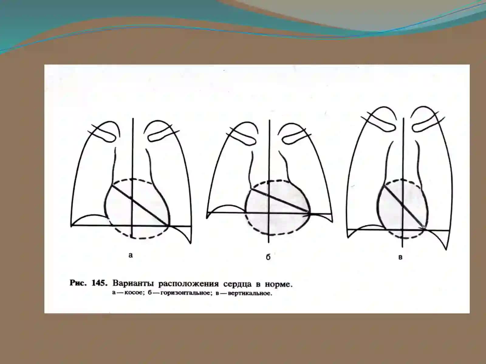 YURAK-QON TOMIR TIZIMINI RADIATSION TEKSHIRISH USULLARI 3
