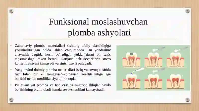 Zamonaviy doimiy plomba ashyolari 3