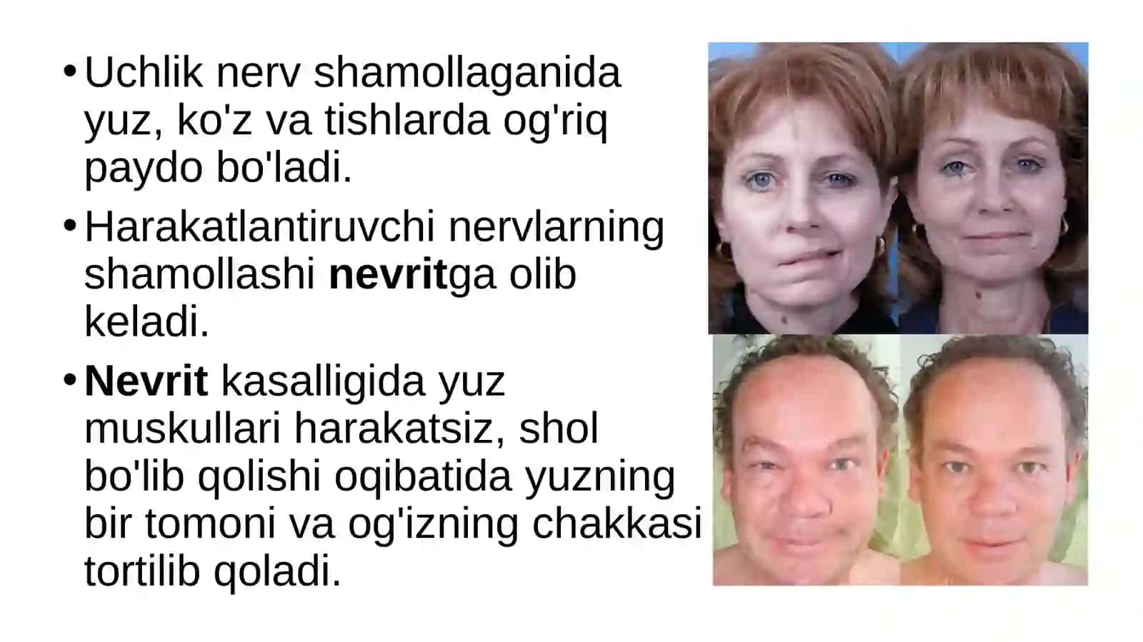 Nerv sistemasi kasalliklari va ularning oldini olish 3
