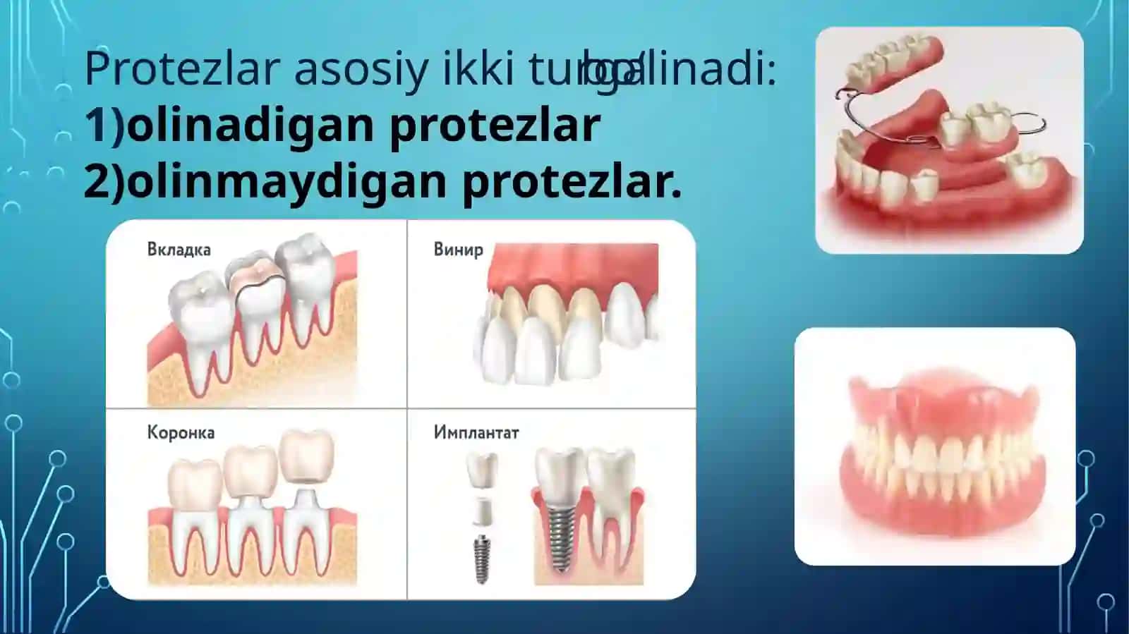 Tishprotezlarning tasnifi 3