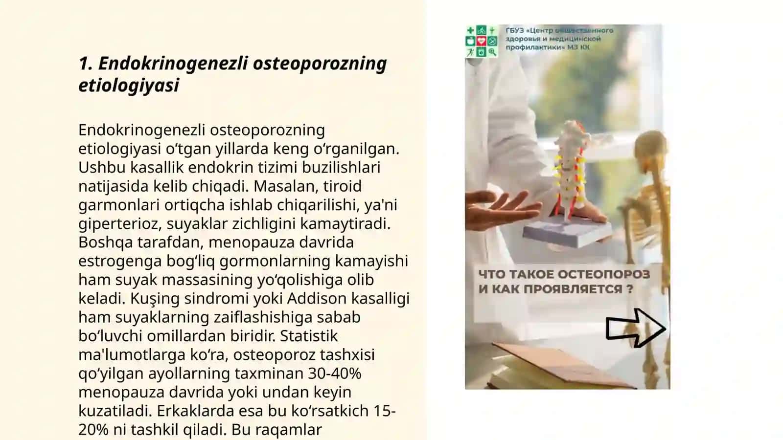 Endokrinogenezli osteoparoz 3