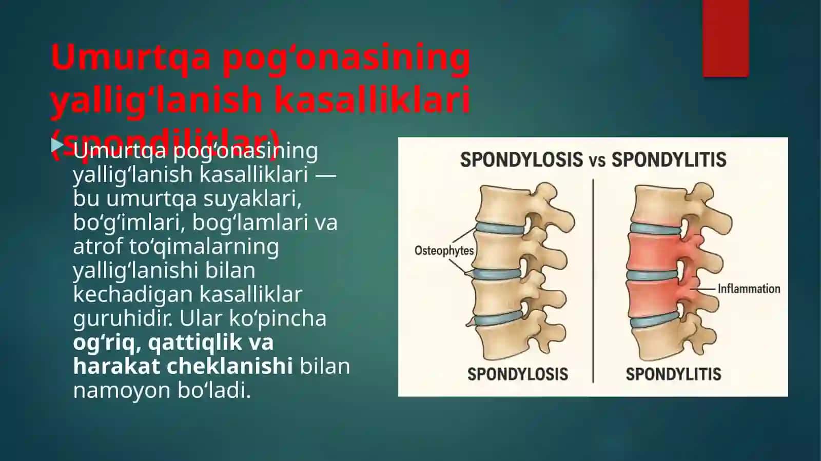 Umurtqa yallig’lanish va degenerativ-distrofik kasalliklari 3