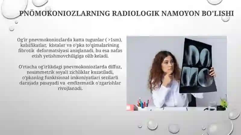 Nafas olish tizimi kasalliklarida turli rentgenologik sindromlar 3