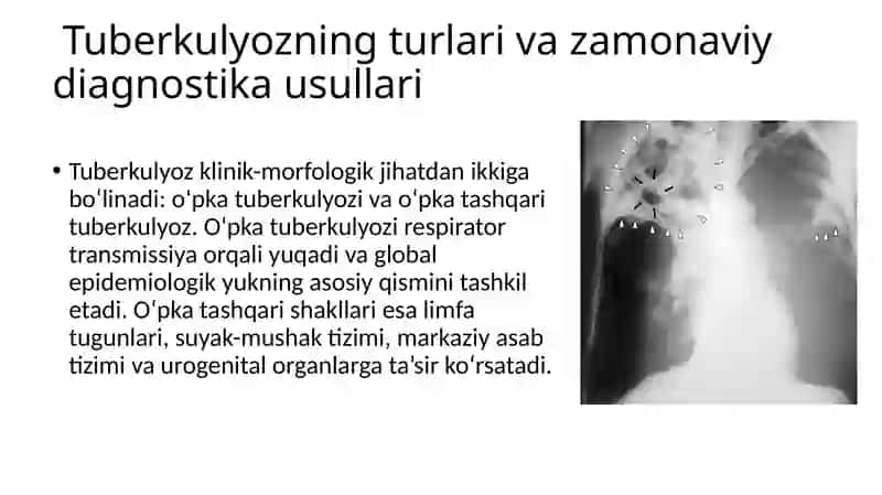 Tuberkulyoz bemorlarini davolash va kuzatish sxemasi 3