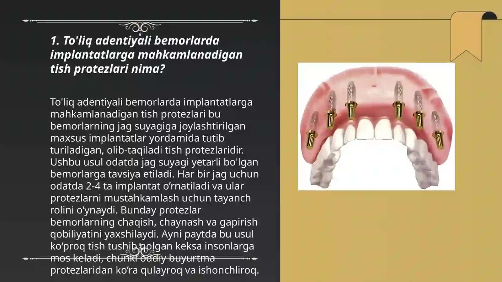 To'liq adentiyali bemorlar implantatlarga mahkamlanadigan tish protezlari 3