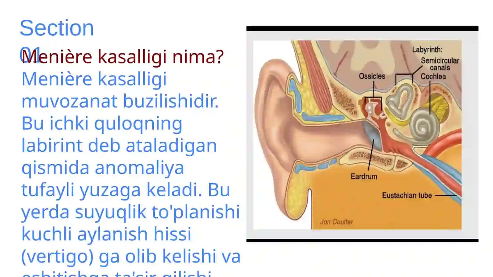Mener kasalligi va zamonaviy davolash usullari 3