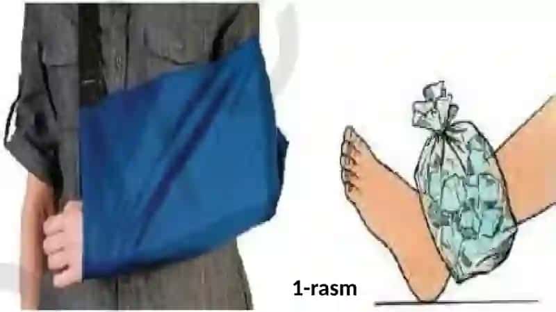 Suyaklar shikastlanganida birinchi yordam ko’rsatish 3