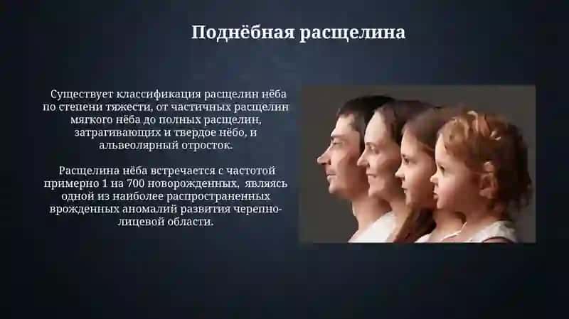 Возрастные особенности неба и его порокиразвития 3