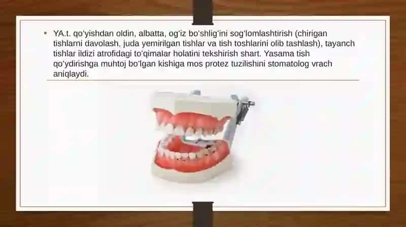 YUQORI VA PASTKI TISHLARNING ANOTOMIK SHAKLLARINI MUMDAN YASASH. O’NG VA CHAP TOMONDAGI TISHLARNING BIR BIRIDAN FARQI 3
