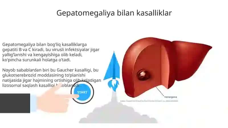 Gepatomegaliya, Jigar sirrozi va Sariqlik 3