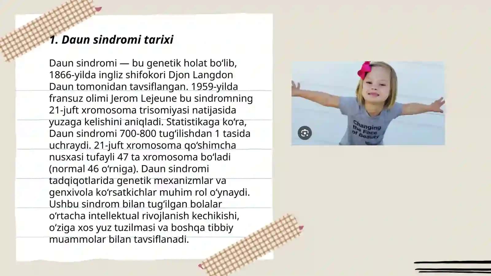 Daun sindromi 3