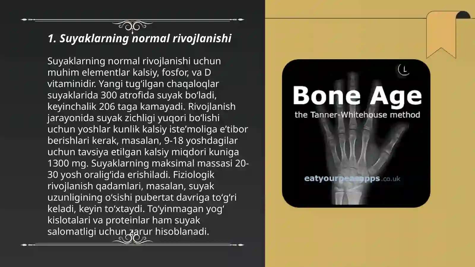 Suyaklarni rivojlanishini buzilishlari.Sinishlar.Osteonekroz 3