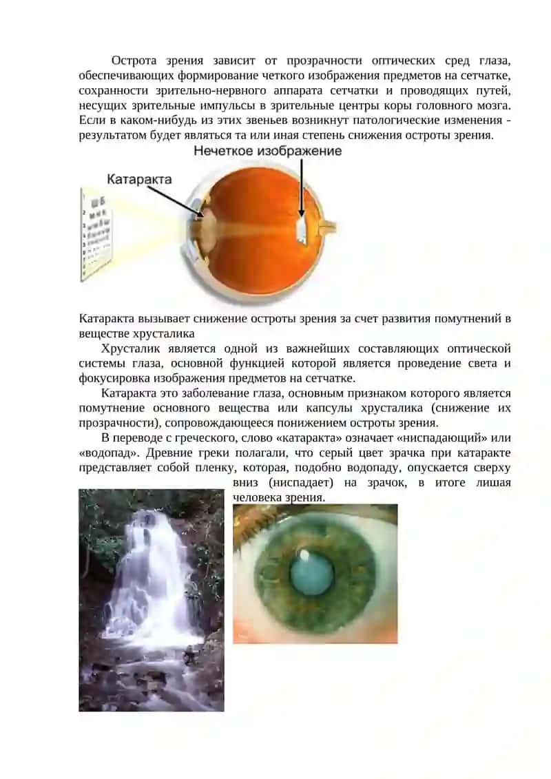 Заболевания сосудистой оболочки и хрусталика 3