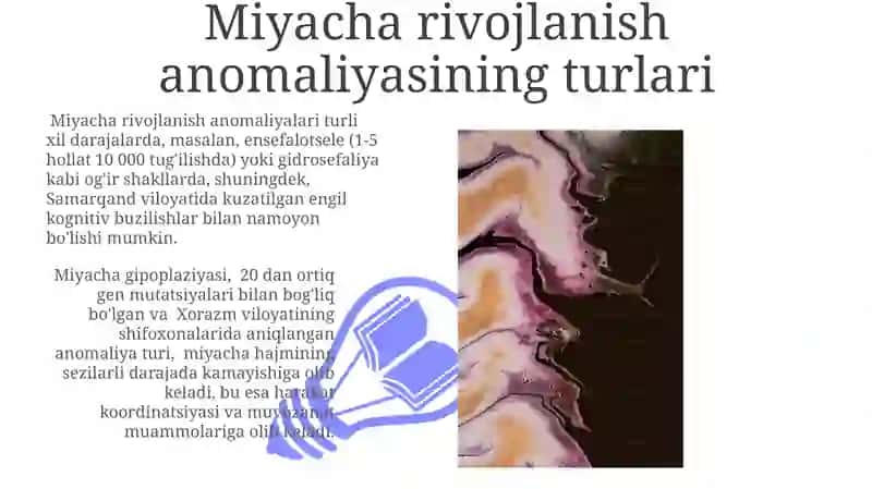 Miyacha Rivojlanish Anomaliyasi 3