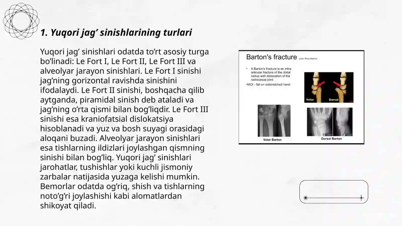 Yuqori jag’ sinishlari 3