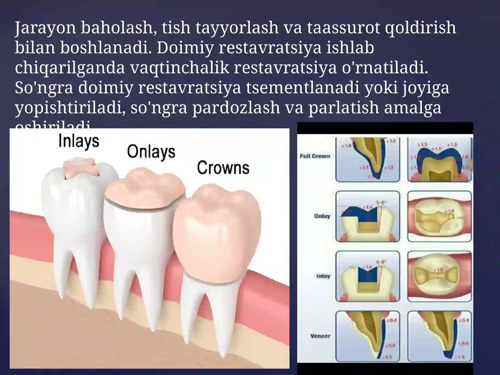 Metallqistirmalarni ishlab chiqarishning klinik va laborator bosqichlari 3