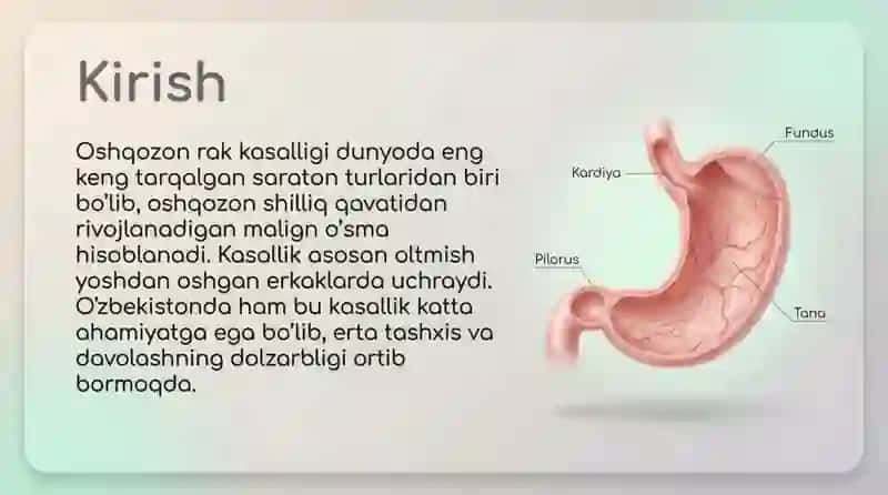 Oshqozon rak kasalligi 3