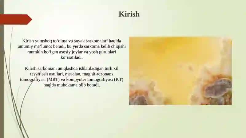 Yumshoq to'qimalar va suyak sarkomasi 3