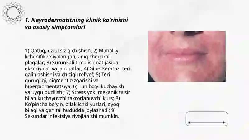 Neyrodermatit koʻrinishi, kechishi va qiyosiy tashxislash, davolash 3