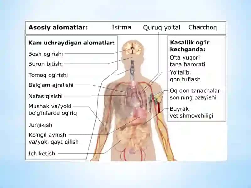 Karonavirus haqida Prezentatsiya 3
