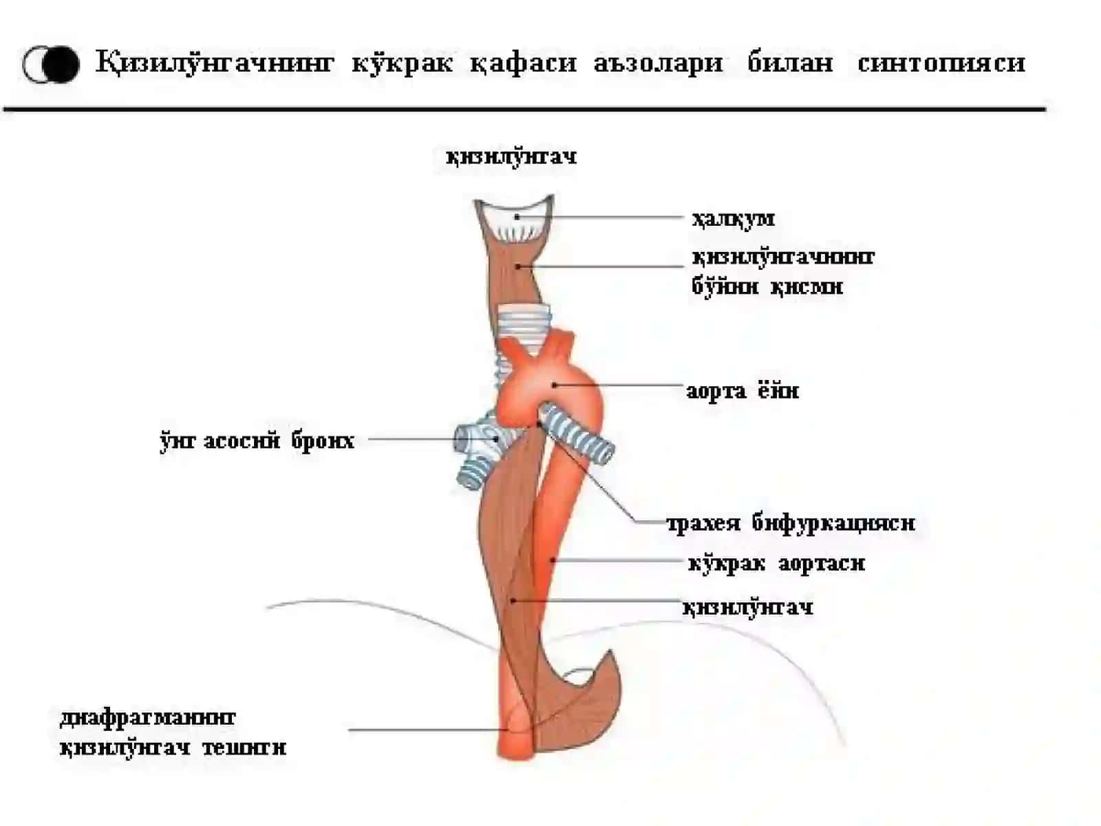 ҚИЗИЛЎНГАЧНИНГ ХИРУРГИК КАСАЛЛИКЛАРИ 3