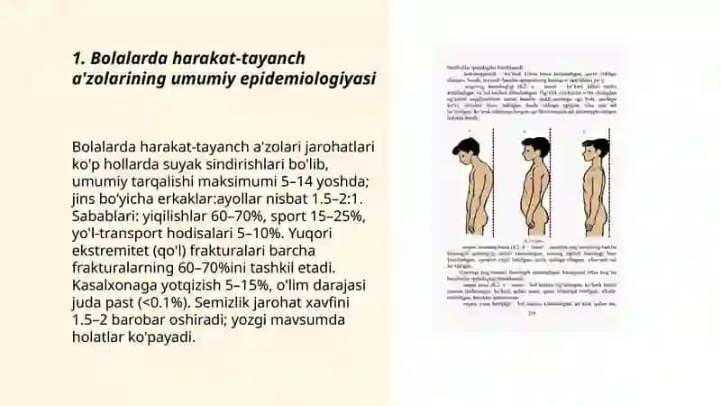 Bolalarda harakat-tayanch a'zolarining umumiy epidemiologiyasi 3