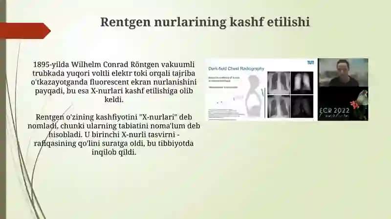 Rentgen nurlarini o'rganish tarixi suyak rengenlari rivojlanishini 3