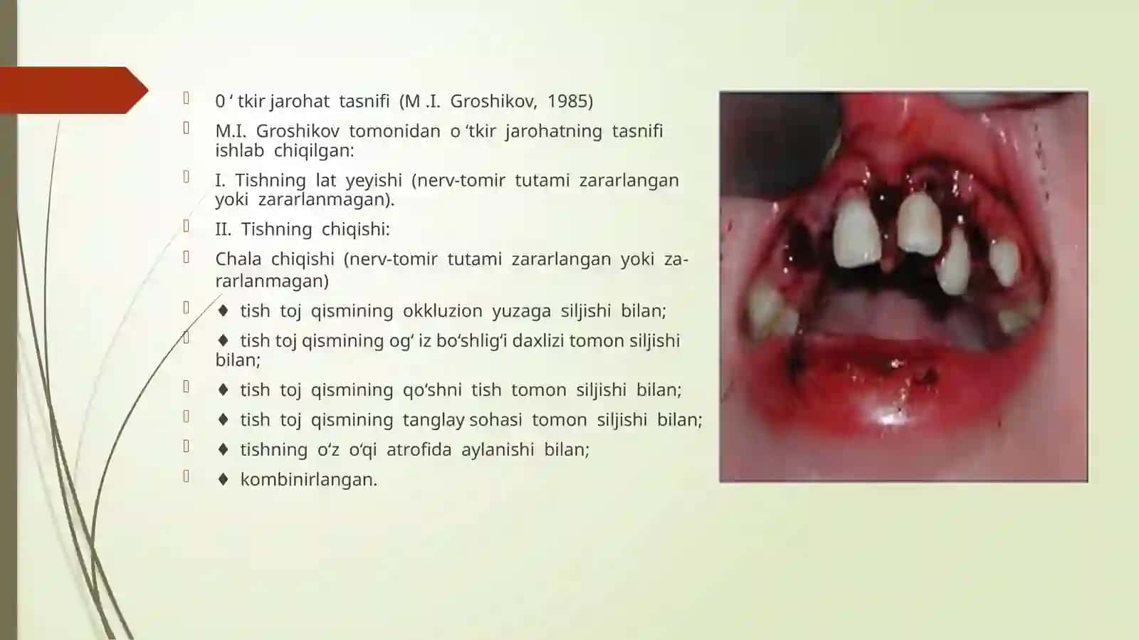 Tish chiqqandan keyin paydo bo'ladigan nokaries kasalliklari 3