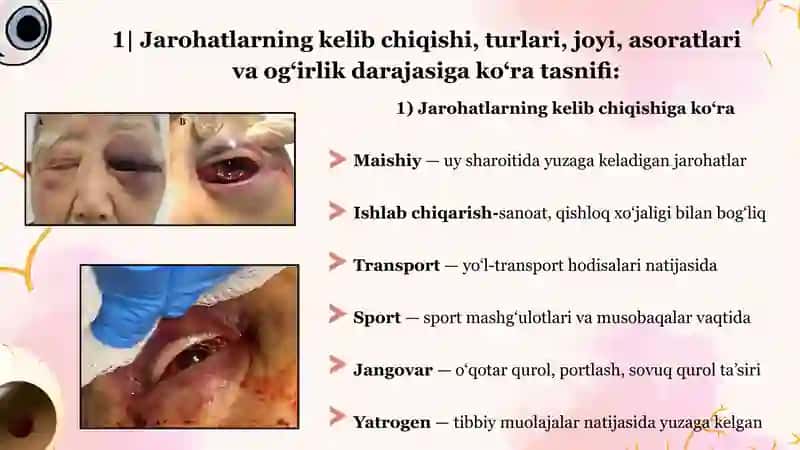 KO‘RUV A’ZOSI JAROHATLARI 3