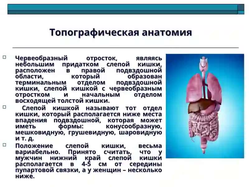 Острый аппендицит и его осложнения 3