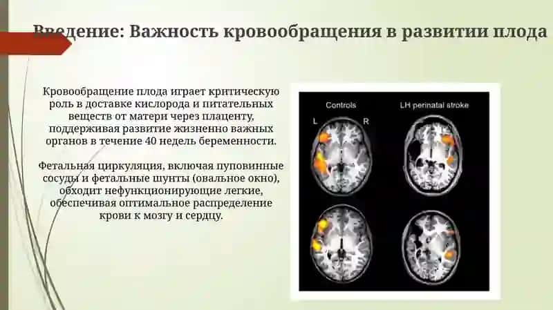 Кровообращение плода: Мать, Плацента и Развивающийся Ребенок 3