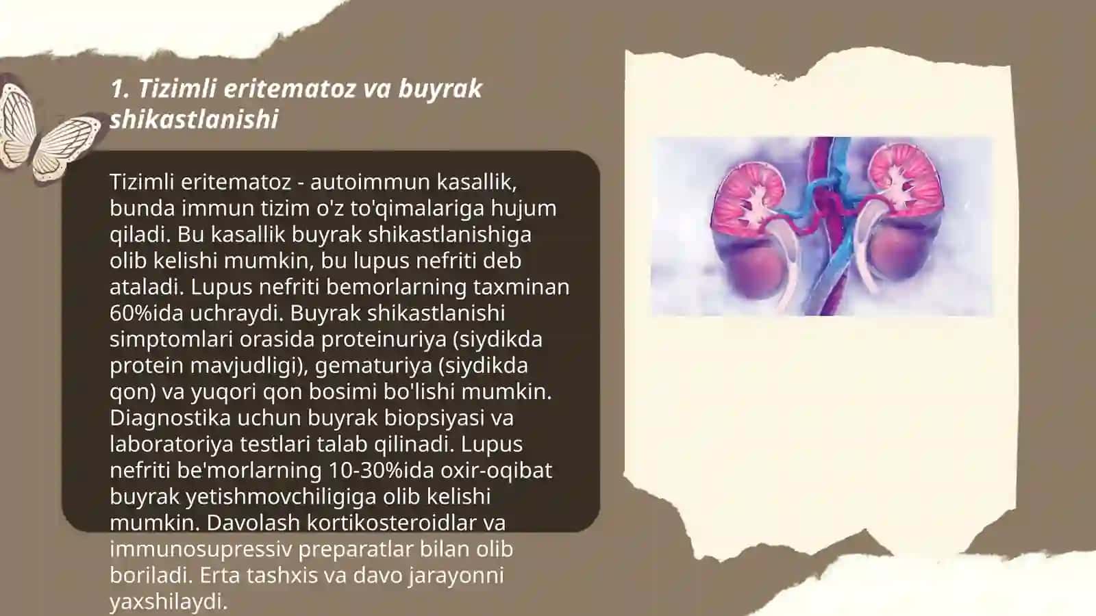 Tizimli eritematoz va buyrak shikastlanishi 3