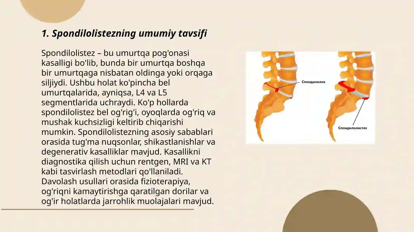 Spondilolistez sabablari, diagnostikasi va prinsipal davolash usullari 3