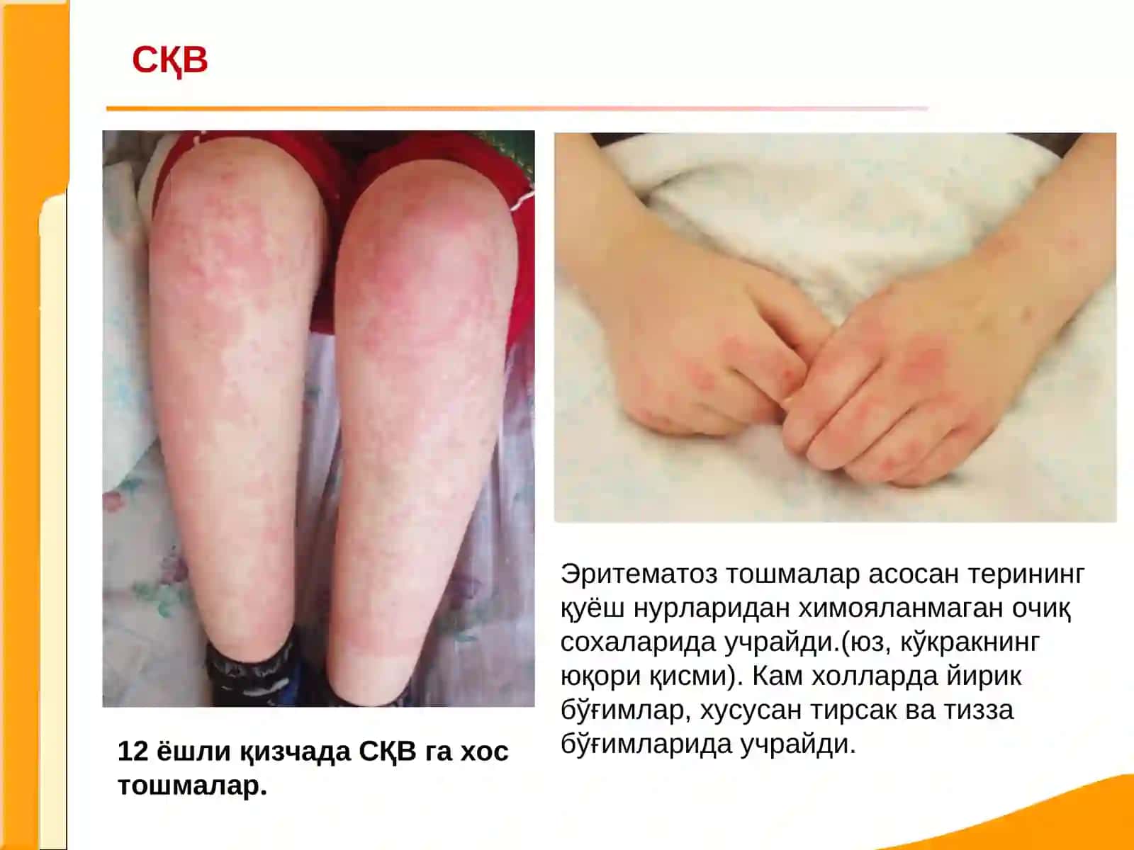 Акасалликларни текшириш 3