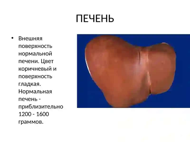 Болезни печени 3