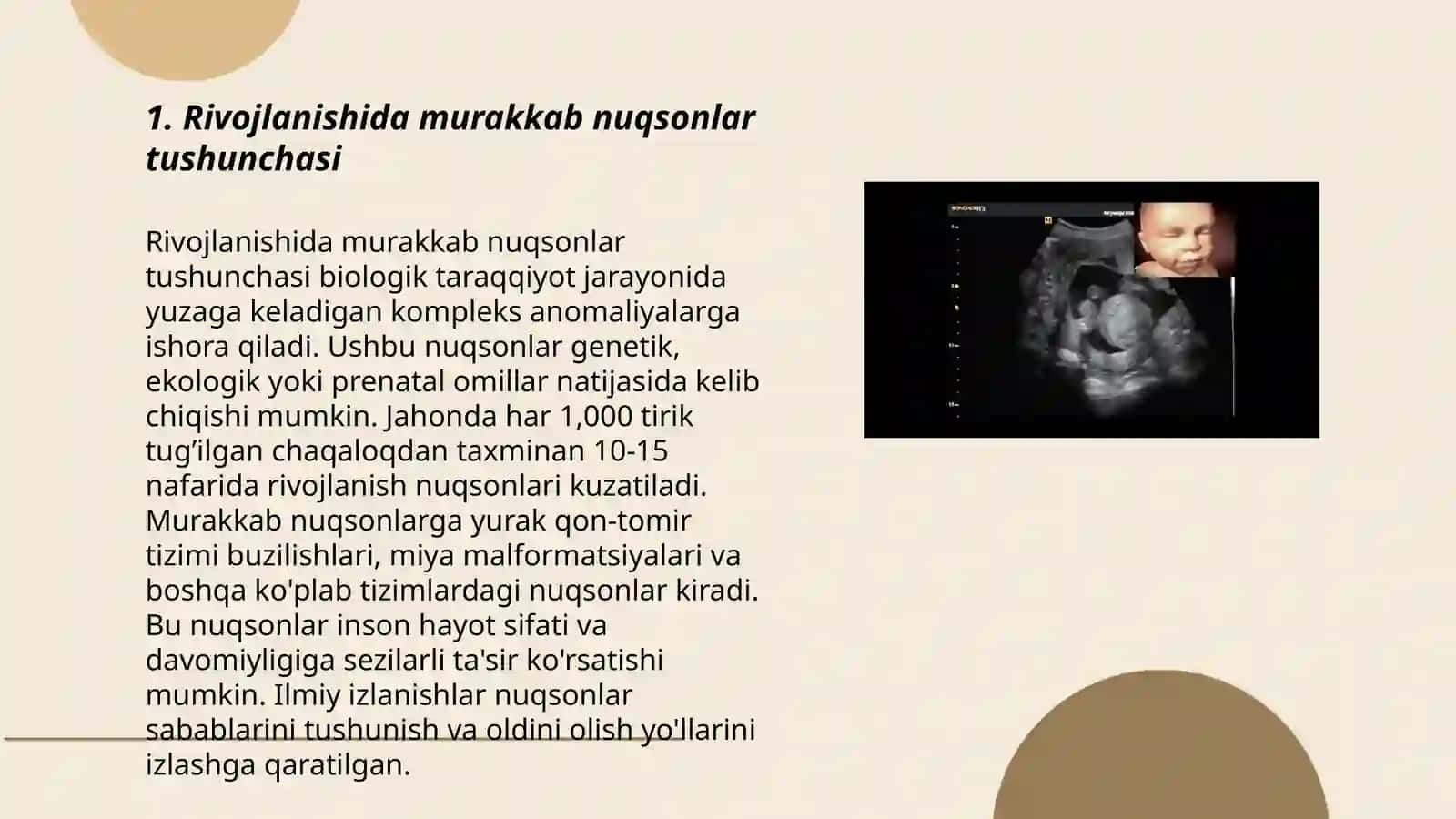 Rivojlanishida murakkab nuqsonlar tushunchasi 3