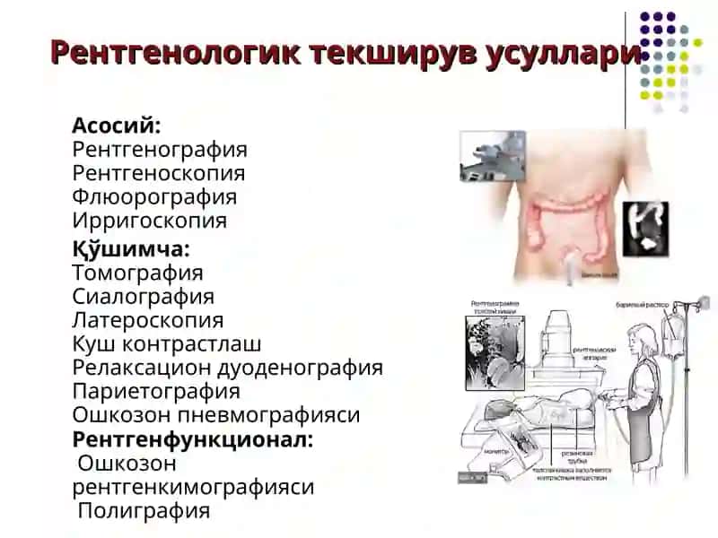 Термиз Иқтисодиёт ва СервисУниверситетиТиббий клиник фанлар кафедраси«Тиббий радиология» фани 5-Маъруза. 3