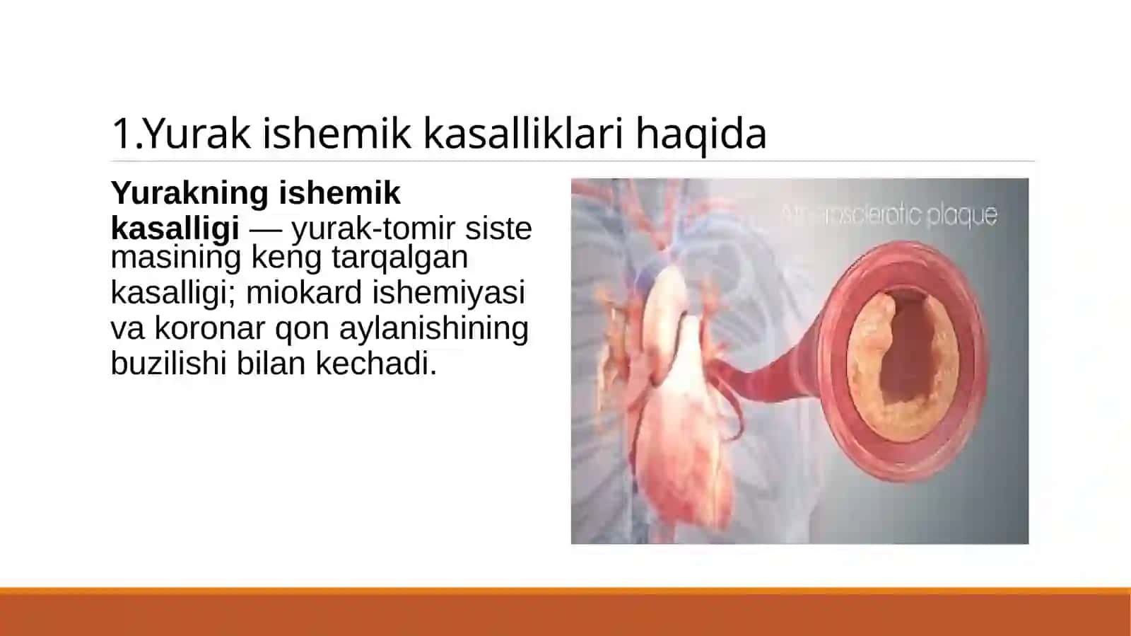 Yurak ishemik kasalliklari 3