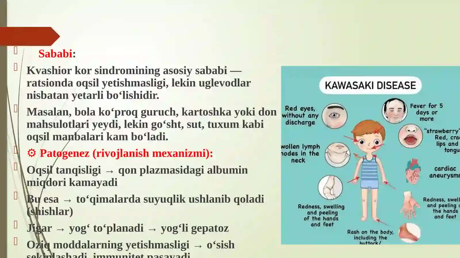 Kvashior sindiromi etiologiyasi patagenezi haqida. 3