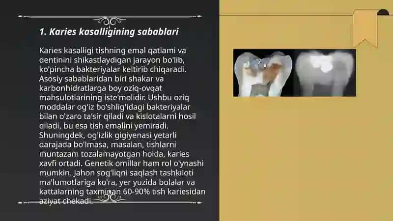 Karies kasalligi 3