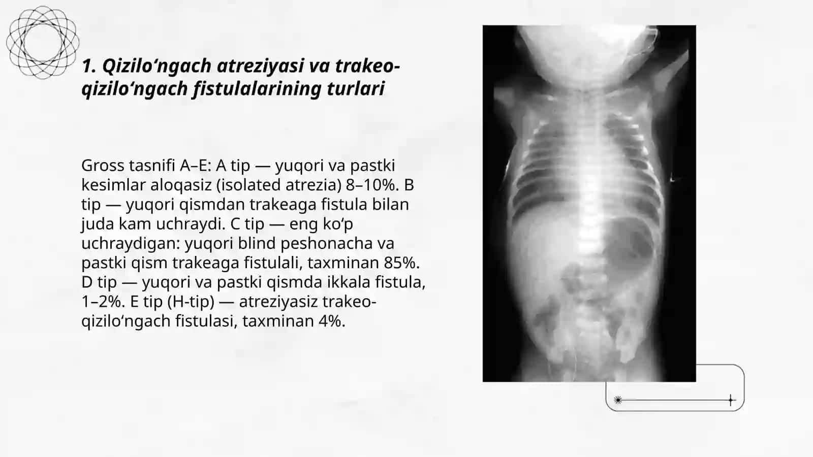 Qiziloʻngach tugʻma nuqsonlari va anomaliyalari 3