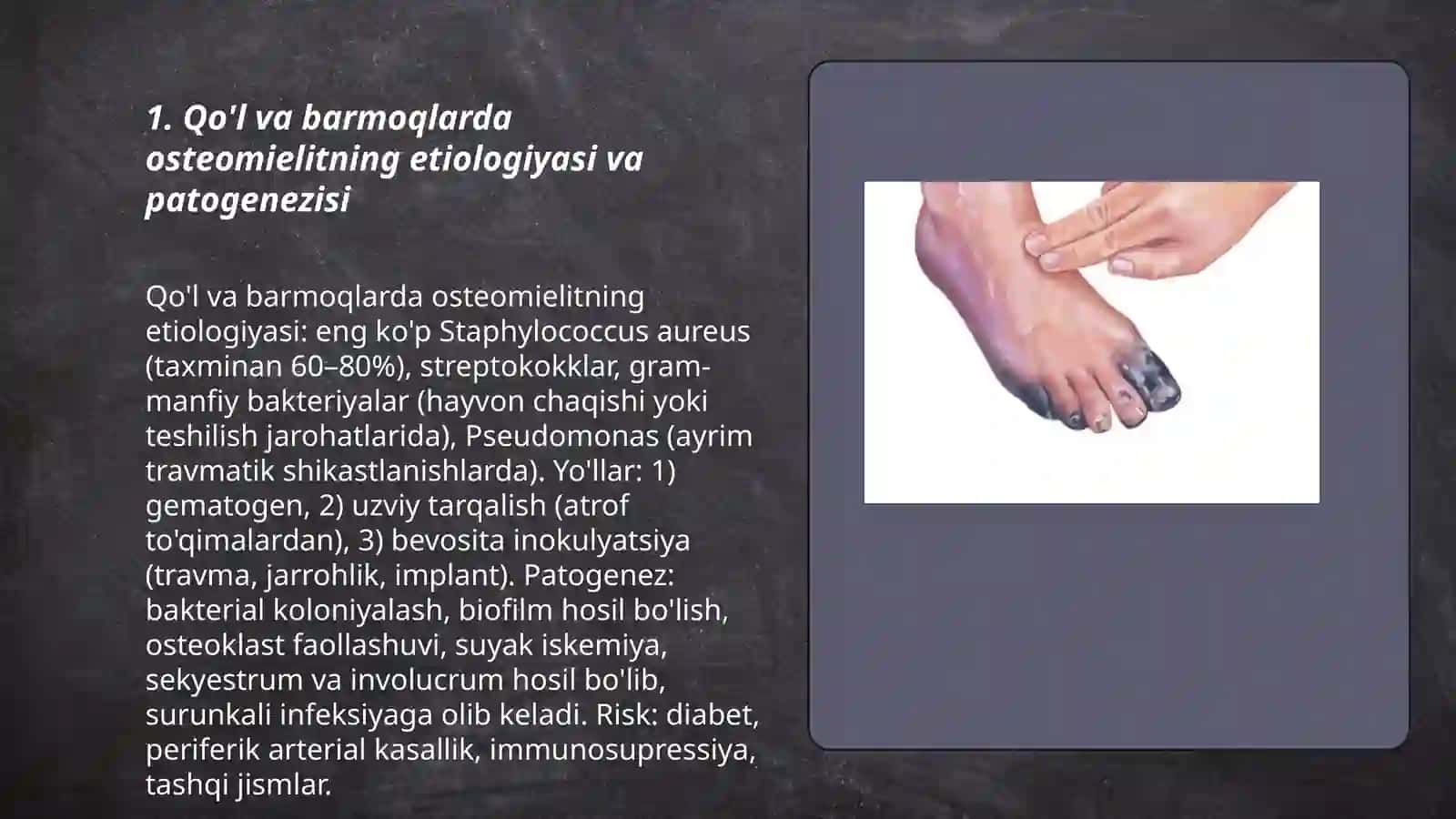 Suyak va bo'g'imlarning xirurgik infeksiyalari 3