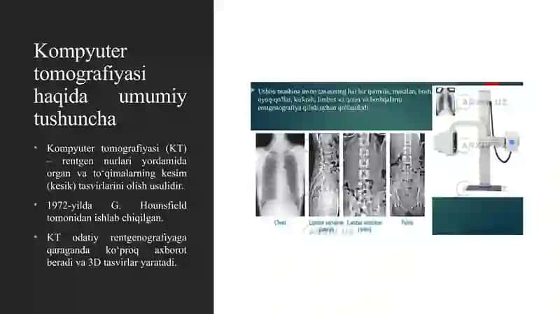 SPIRAL KOMPYUTER TOMOGRAFIYASI (SKT) 3