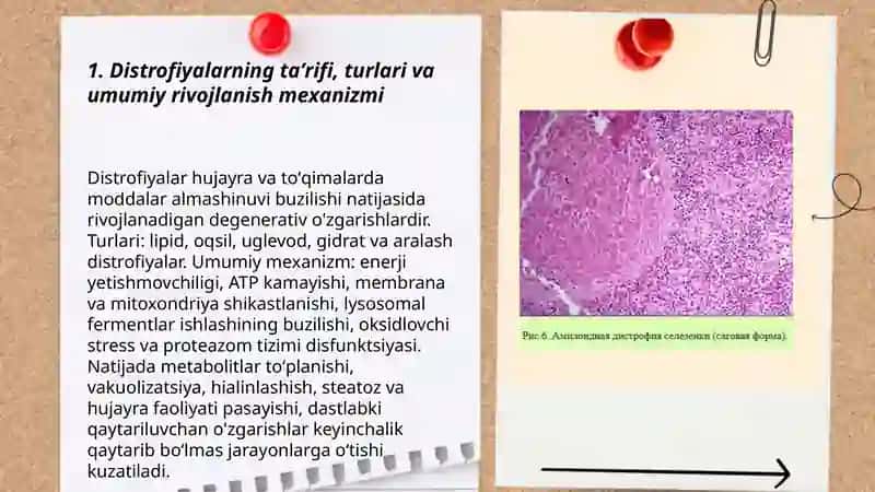 Distrofiyalar 3