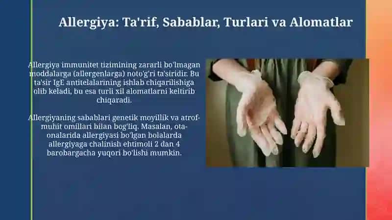 Allergiya 3