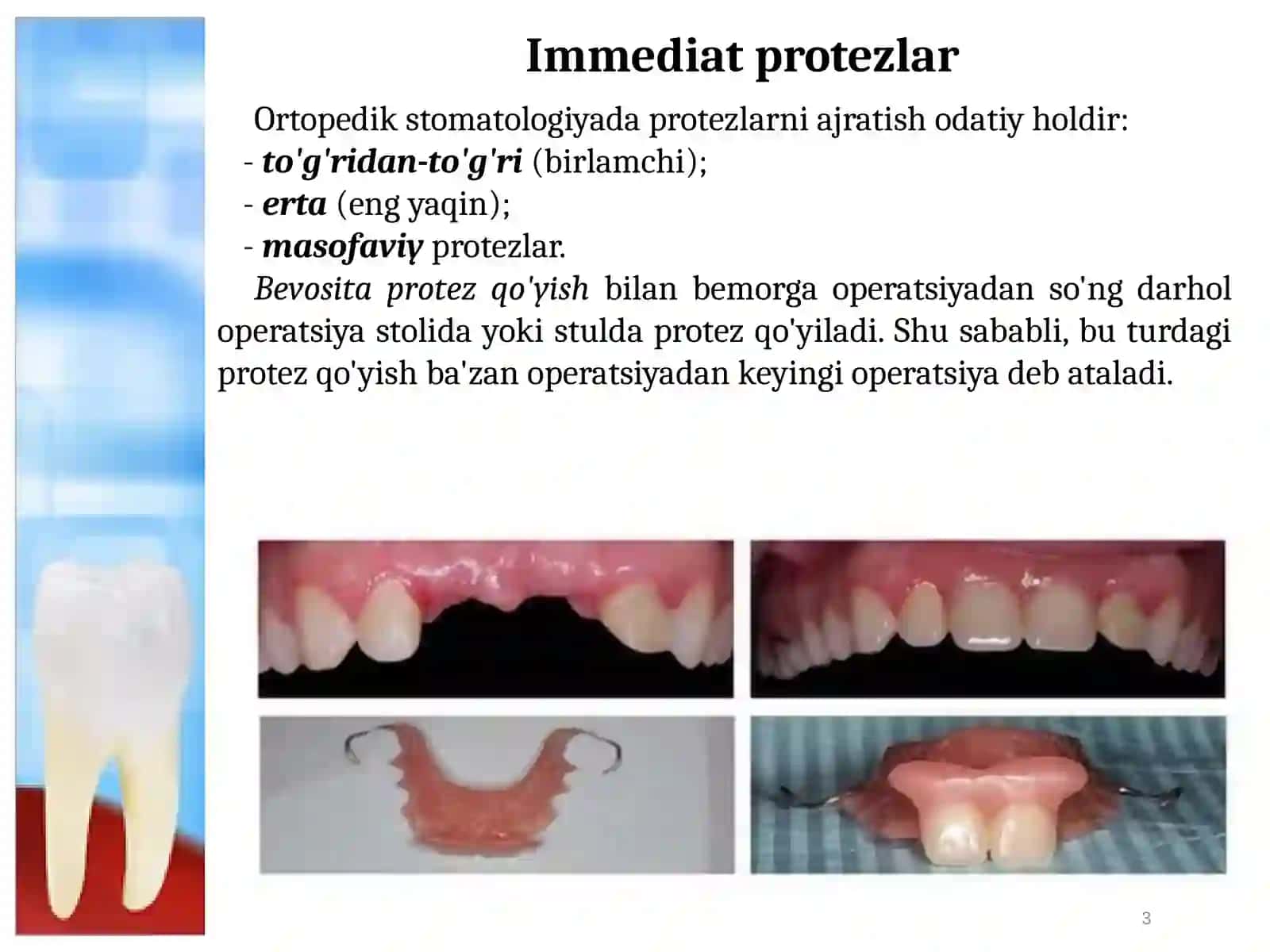 Immediat protezlar. Ko’rsatmalar. Immediat protezlarni tayyorlashning klinik–laborator bosqichlari. 3